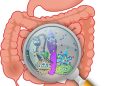 Microbiomul intestinal ar putea crește eficiența chimioterapiei