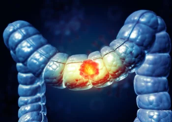 Un test simplu la domiciliu reduce cu 43% riscul de deces prin cancer colorectal
